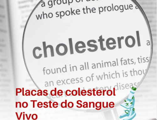 Placas de ColesterolTeste Sangue Vivo